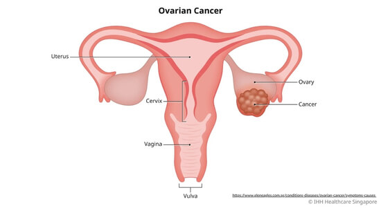 Counselling for Cancer Patients â€“ Cancer Control Mission